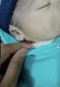 Imagens fortes | Por negligência durante o parto, bebê teve a cabeça degolada por enfermeira em Belém 7 BAEB6BAF 96B3 45F1 8711 C28E787E9B7A