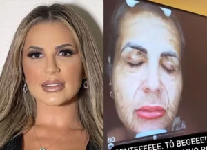 5215415 1024x742 1