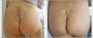 antes e depois rabo 1024x422 1