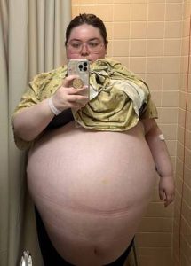 tumor 47kg 29032023150806097 1