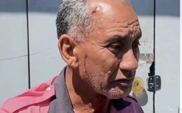 Motorista de ônibus é agredido com canetada na cabeça em Manaus