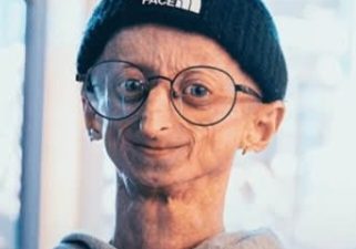 Michiel Vandeweert, influenciador belga que convivia com progeria, morreu aos 28 anos