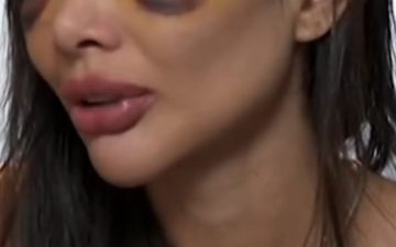 Dentista denuncia marido por violência doméstica e relata agressões no rosto e na cabeça