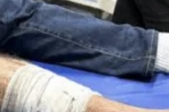 Capitão da PM é baleado durante preparativos para comício político em Manaus